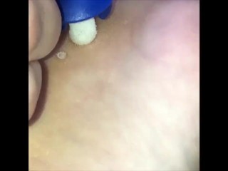 Cleaning And Bitter Say No To Disreputable Warts (moans)
